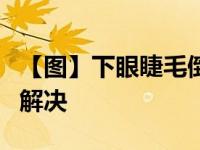 【圖】下眼睫毛倒長是怎么回事 4種方法教你解決